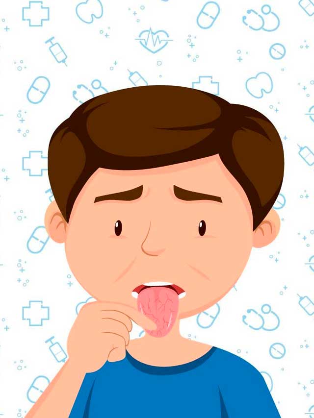 Color de la lengua, esto puede decir de tu salud
