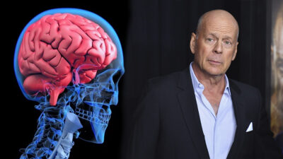 Afasia: qué es la enfermedad que obligó a Bruce Willis a dejar la actuación