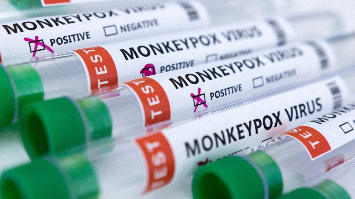 La viruela del mono no es una emergencia sanitaria global: OMS