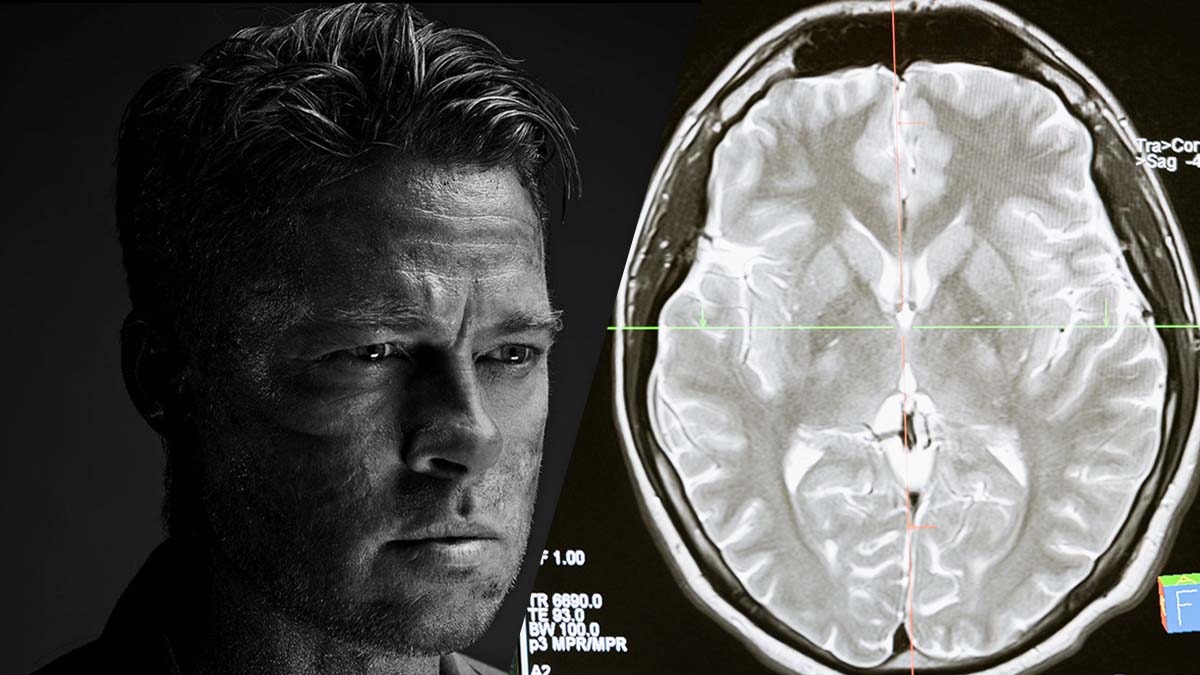 Prosopagnosia: ¿qué es el extraño síndrome que sufre Brad Pitt?
