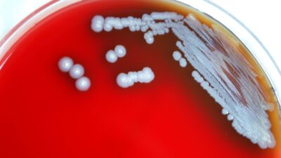 Cdc Alerta Bacteria Burkholderia Pseudomallei Melioidosis Ok
