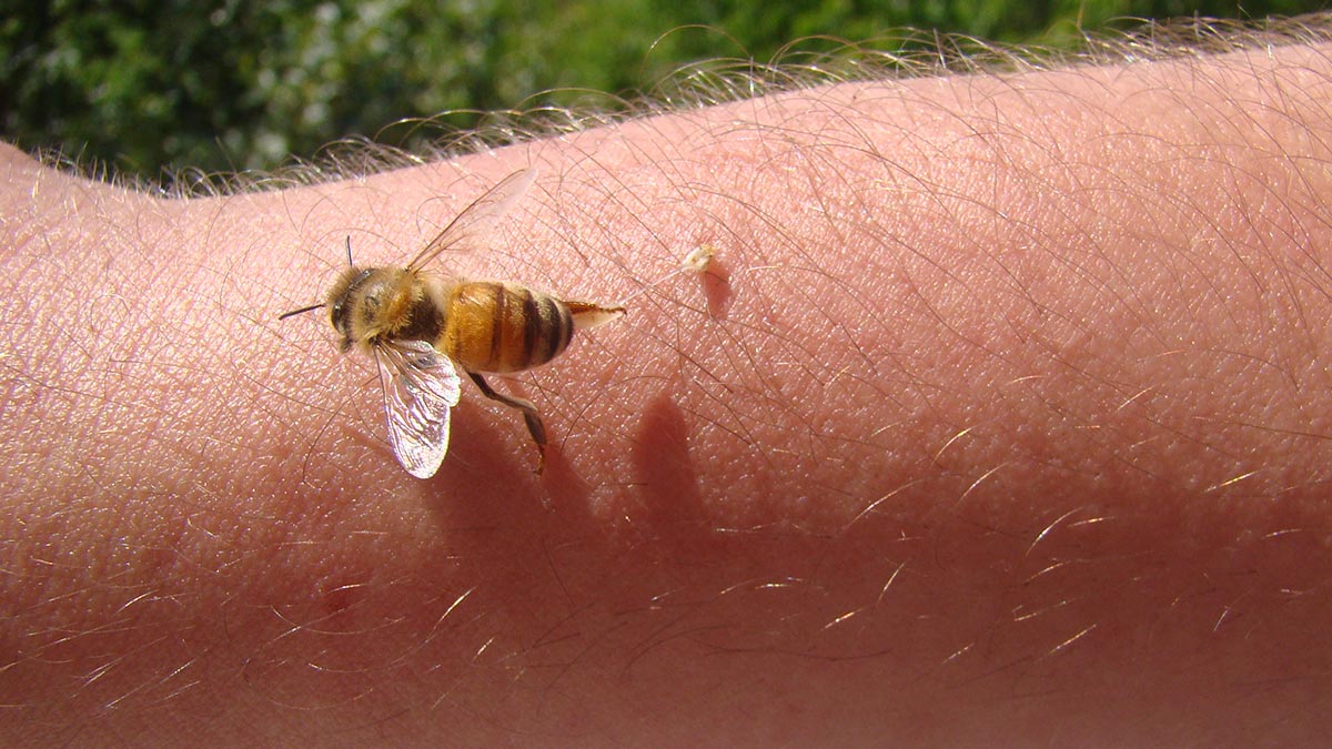 Niño recibe más de mil piquetes de abeja y sobrevive; fue por proteger a su hermanito