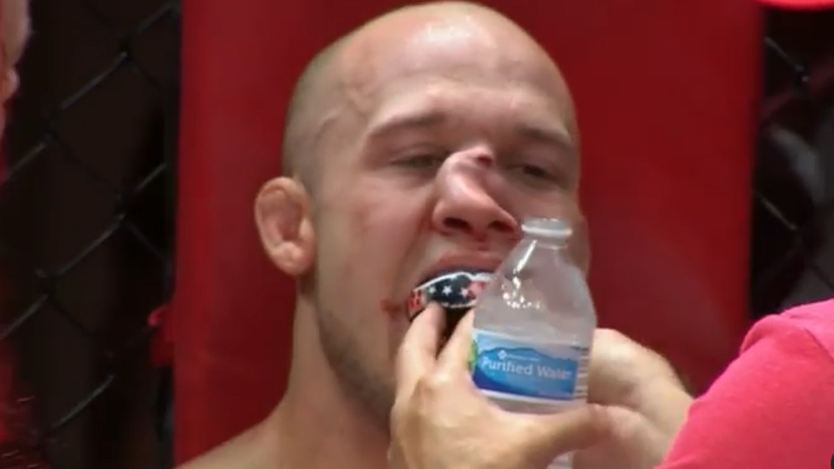 Blake Perry termina con la nariz desfigurada tras pelea de MMA