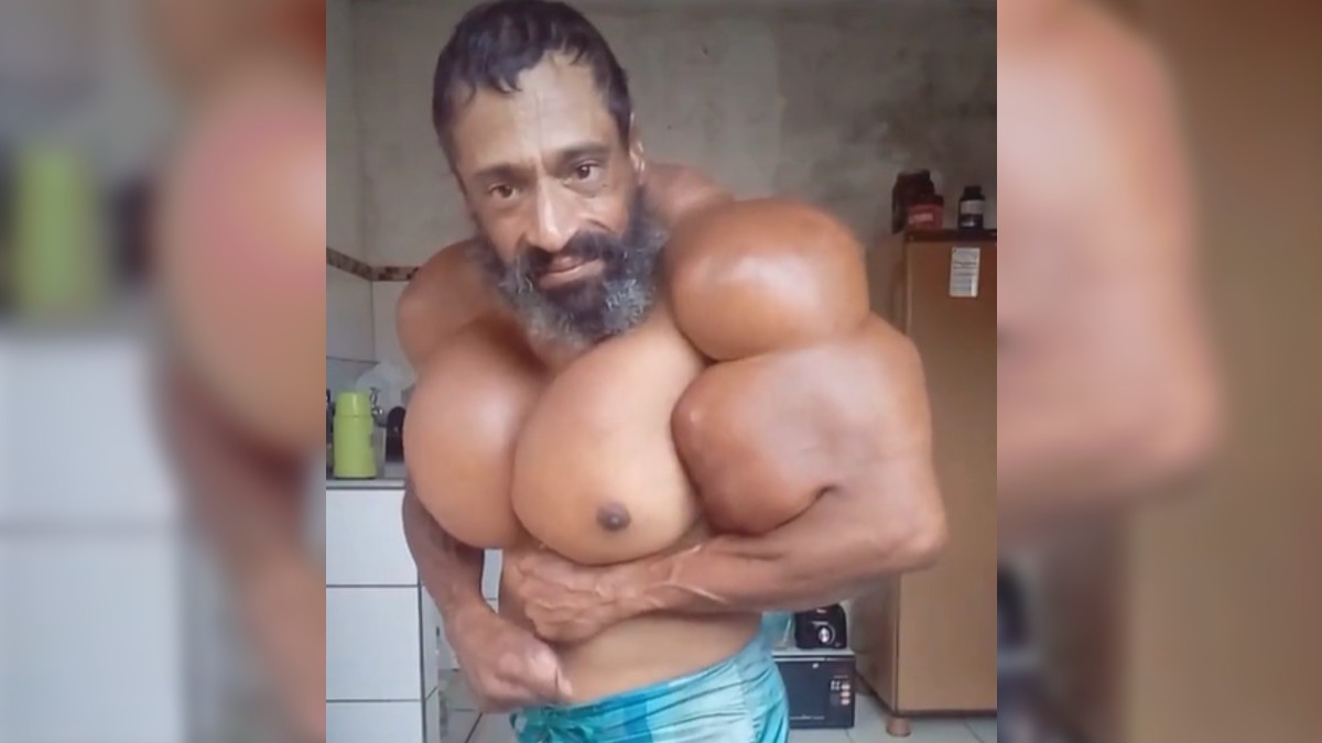 Muere el “Hulk brasileño”, fisicoculturista que se inyectaba aceite en sus músculos