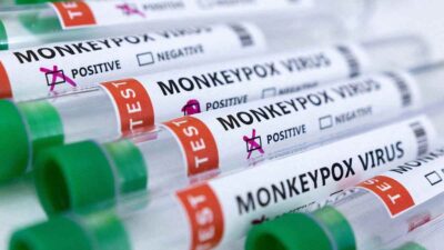 Viruela del mono: Estados Unidos declara emergencia sanitaria por el virus