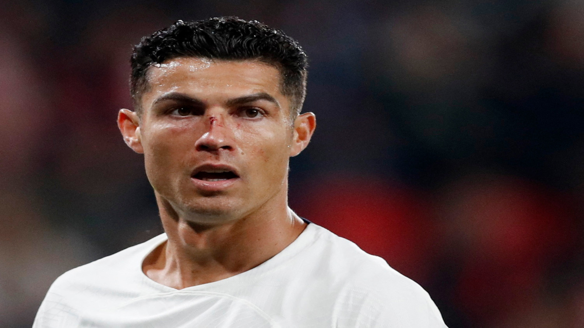 ¡En la cara no! Cristiano Ronaldo sufre fuerte golpe que lo deja sangrando