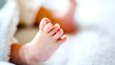 Nace bebé con cola de 6 cm en Nuevo León