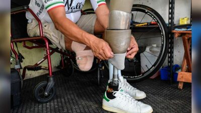 Morelos: se instalan prótesis de rodilla y cadera gratis