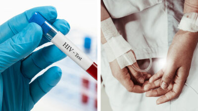 VIH: tercer paciente logra curarse tras trasplante de células madre