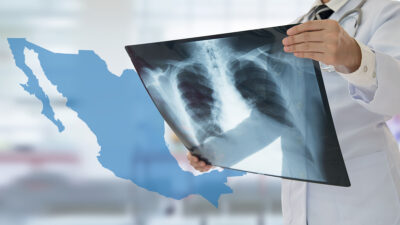 Tuberculosis en México