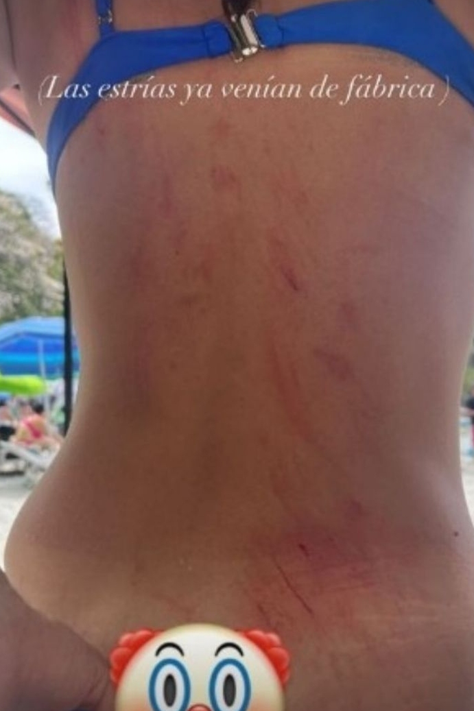 Tania Rincón comparte “fuerte” accidente en playa durante sus vacaciones en Costa Rica
